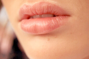 Filtro Imágenes Destacada de servicios - Relleno de labios